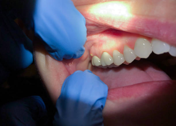 Best Mobile Emergency Dentist in Bargersville, IN