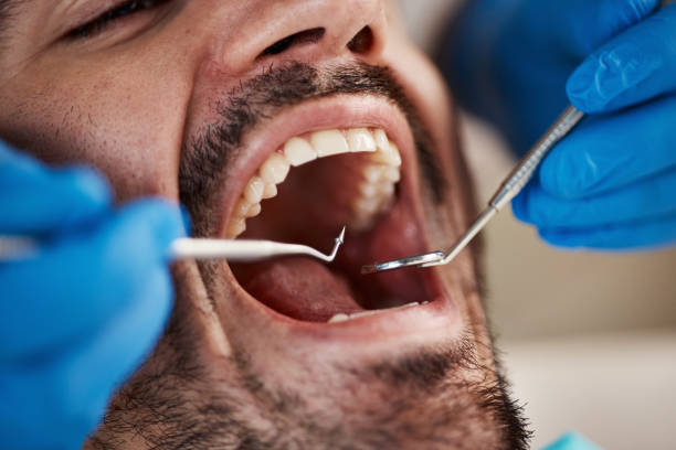 Best Pediatric Emergency Dentist in Bargersville, IN