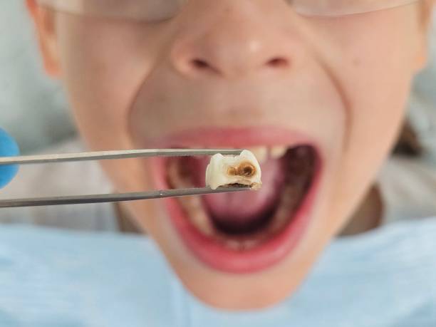 Best Emergency Cosmetic Dentistry in Bargersville, IN