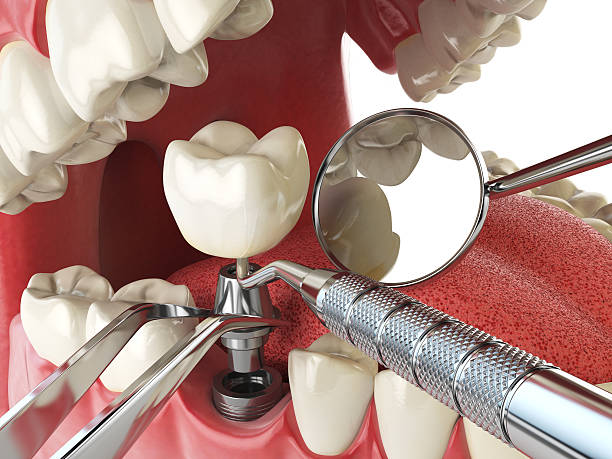 Best Emergency Dental Extractions in Bargersville, IN